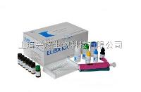 人抗脱氧核糖核蛋白抗体（DNP-Ab）elisa试剂盒 