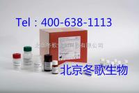 北京销售人血浆HSP70抗体（HSP70）ELISA试剂盒--elisa酶联**方法检测 