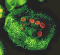 人骨髓瘤细胞 U266细胞 