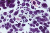 大鼠肾上腺嗜铬细胞瘤细胞（未分化） PC-12细胞 