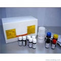 血清低密度脂蛋白胆固醇（LDL-C）测试盒（干粉） 