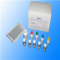 人血小板衍生生长因子BBELISA试剂盒 人PDGF-BB试剂盒免费代测 