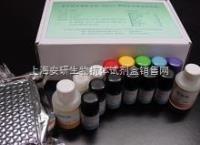 人黑色素瘤标记物（MART/Melan-A）ELISA试剂盒 
