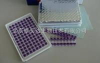 免费代测人丙氨酸转氨酶/谷丙转氨酶（ALT/GPT）ELISA Kit ，北京现货ELISA试剂盒 