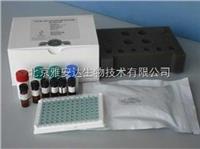 *新科研人幽门螺旋杆菌IgM（Hp-IgM）ELISA Kit ，北京现货ELISA试剂盒 