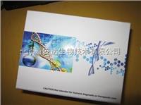 原装促销人乙型肝炎病毒X蛋白相互作用蛋白（HBXIP）ELISA Kit，北京现货ELISA试剂盒 