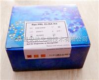 现货促销人L苯丙氨酸解氨酶（PAL）ELISA Kit ，*新报价ELISA试剂盒 