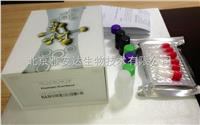 免费代测人毒性休克综合征**1（TSST-1）ELISA Kit ，北京特价ELISA试剂盒 