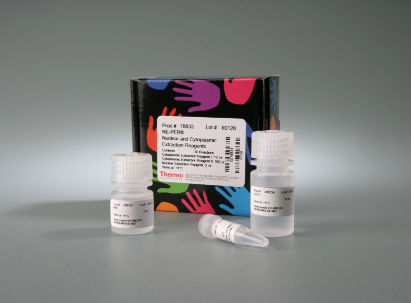 小鼠胰岛素自身抗体ELISA试剂盒,IAA定量检测试剂盒,英文学名:Mouse insulin autoantibodies,IAA ELISA Kit,生物学名:小鼠胰岛素自身抗体(IAA)ELIS试剂盒,科研名称:小鼠胰岛素自身抗体(IAA)ELISA检测试剂盒实验名称:小鼠胰岛素自身抗体(IAA)定量检测试剂盒 产品原理:胰岛素自身抗体,胰岛素抗体的出现有两种情况,一种出现于接受外源性胰岛素治疗的病人,主要和胰岛素制剂的纯度有关系,一种出现于从未接受胰岛素治疗的病人,称为胰岛素自身抗体。胰岛素自身抗