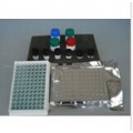 人抗内因子抗体(IFA)ELISA试剂盒 