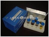 人尿嘧啶核苷磷酸化酶1（UPP1）检测试剂盒 