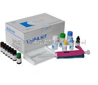 人乙酰胆碱酯酶（AChE）ELISA试剂盒特价促销 