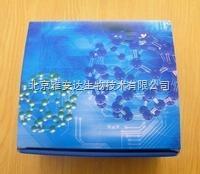 北京特价人膀胱肿瘤抗原（BTA）ELISA Kit，现货供应ELISA试剂盒 