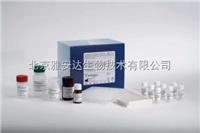 *新报价人尿嘧啶核苷磷酸化酶1（UPP1）ELISA Kit，现货供应ELISA试剂盒 