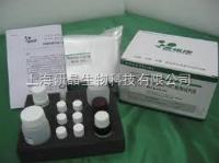 人淀粉酶（Amylase）ELISA试剂盒代测Kit 